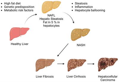 Immune system dysregulation in the pathogenesis of non-alcoholic steatohepatitis: unveiling the critical role of T and B lymphocytes